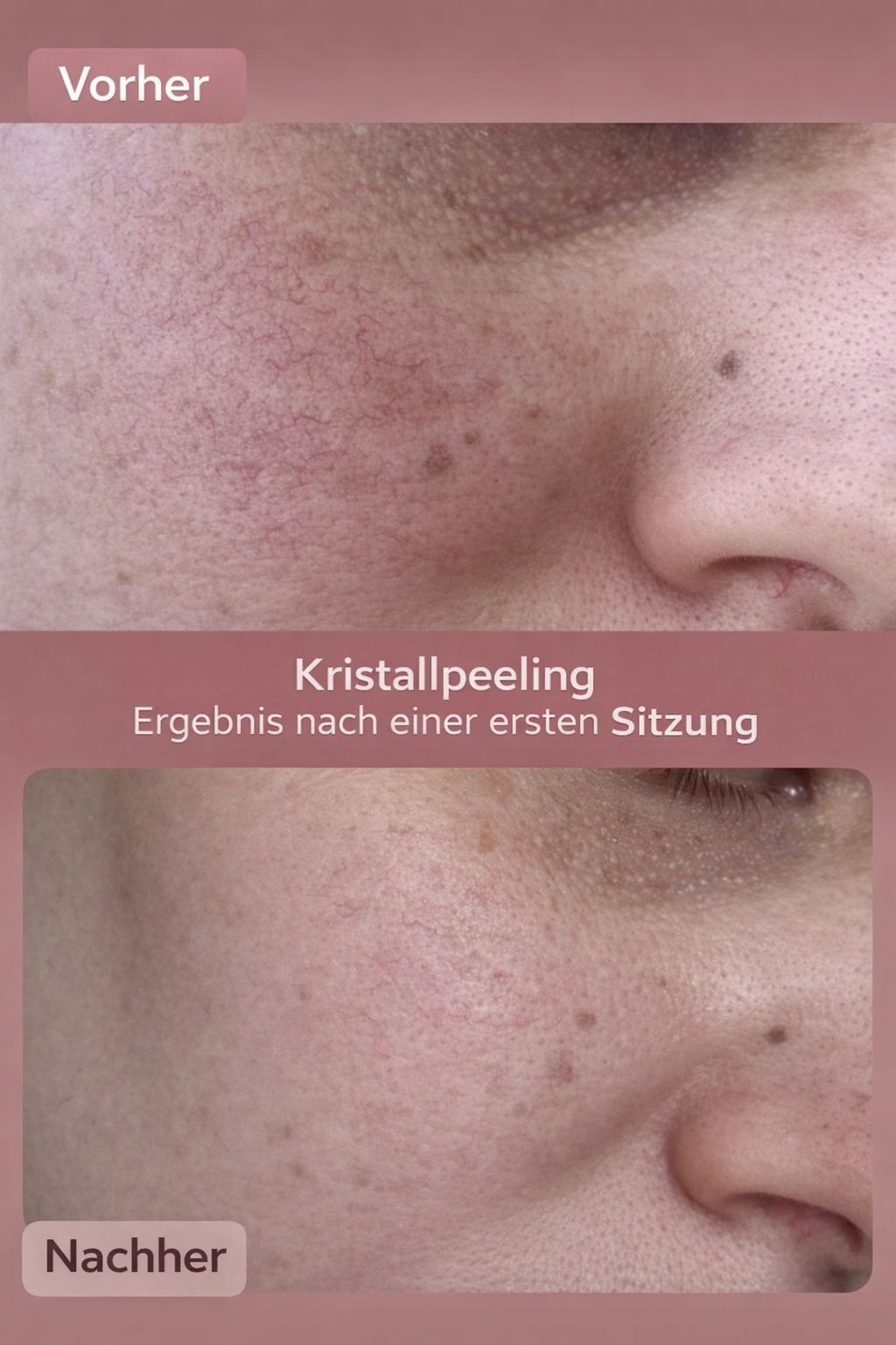 Diodenlaser Technologie