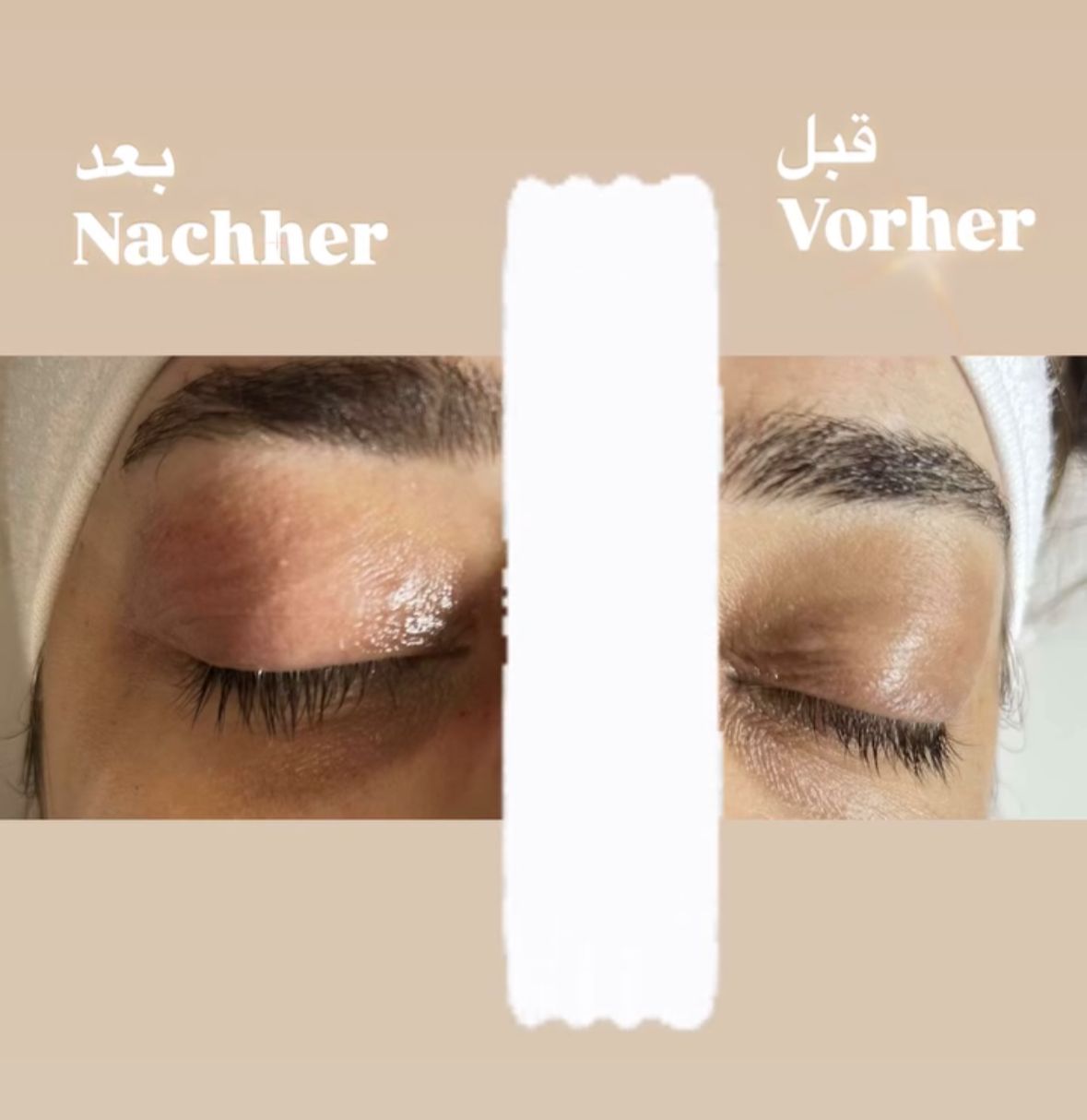 Lash Lifting